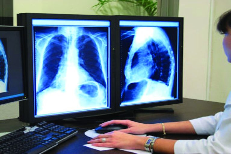 Aksaray Üniversitesi Eğitim ve Araştırma Hastanesi tomografi raporlama hizmeti alacak