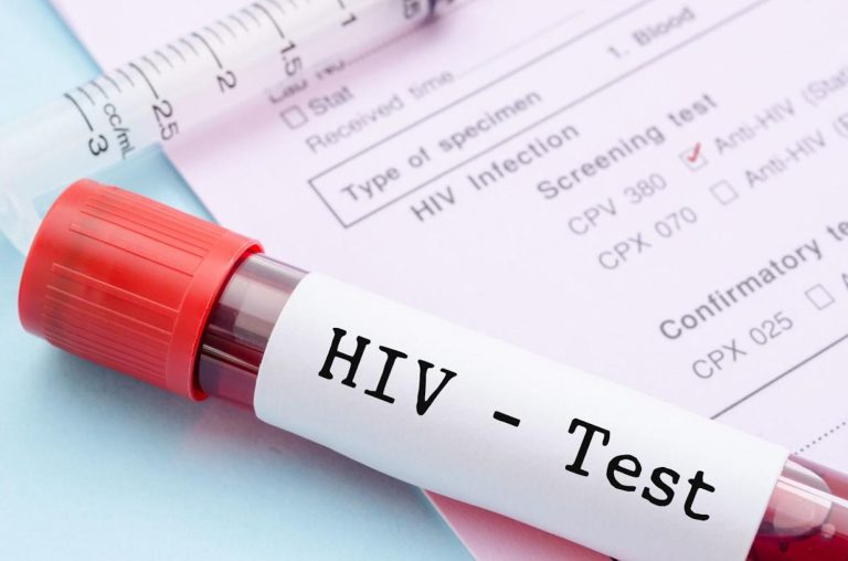 Dünyada 40 milyon kişi HIV ile yaşıyor