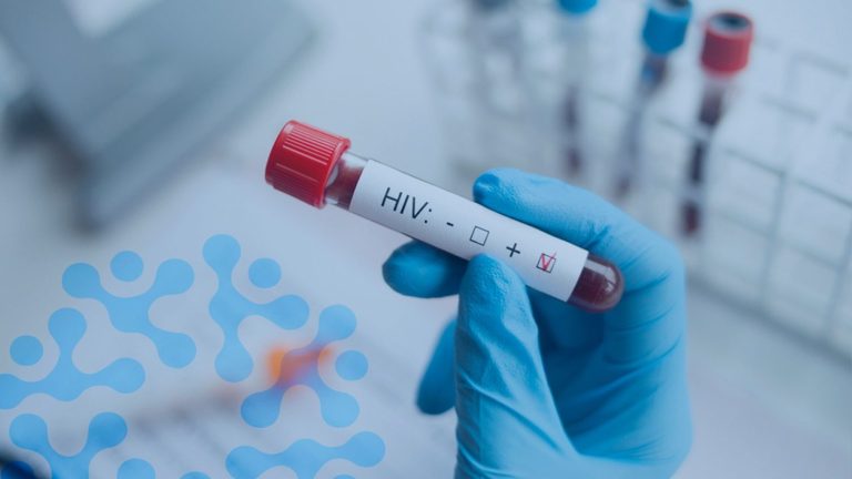 İzBB’den yurttaşlara HIV testi desteği